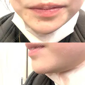 口コミ