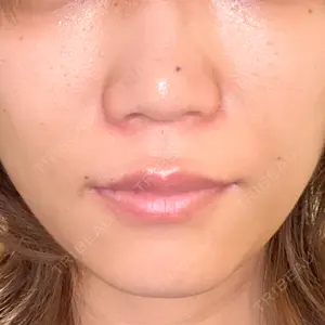 口コミ