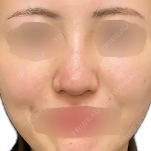 口コミ