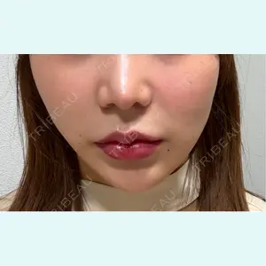 口コミ