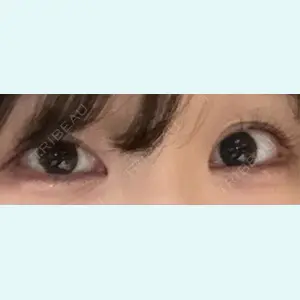 口コミ