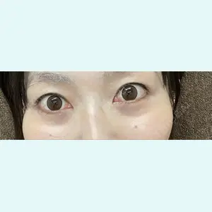 口コミ
