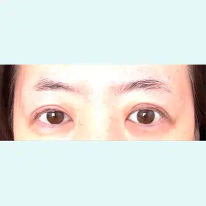 口コミ