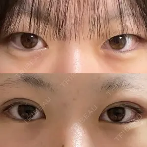 口コミ