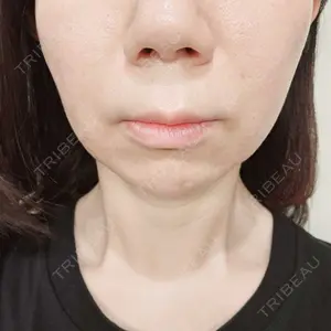 口コミ