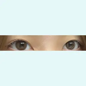 口コミ