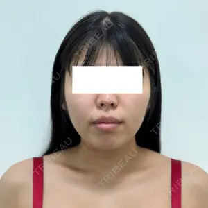 口コミ
