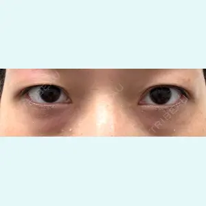 口コミ