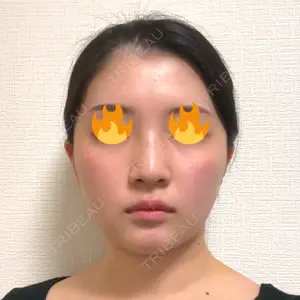 口コミ