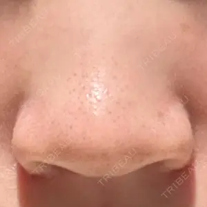 口コミ