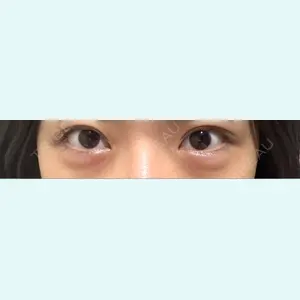 口コミ