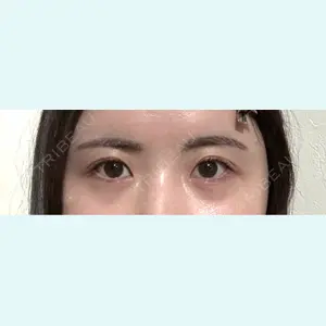 口コミ