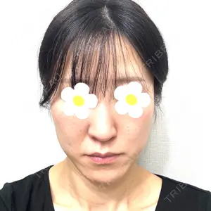 口コミ