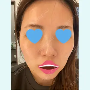 口コミ