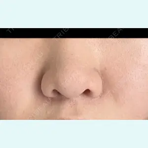 口コミ