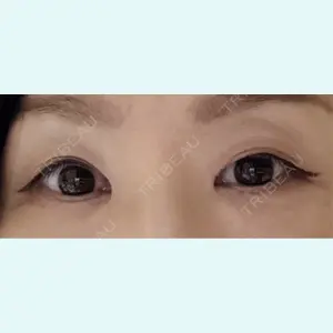 口コミ