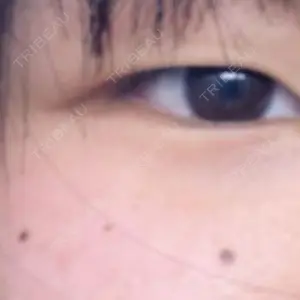 口コミ