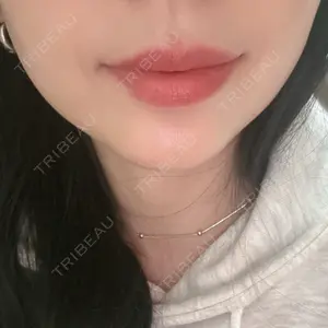 口コミ