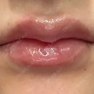 口コミ