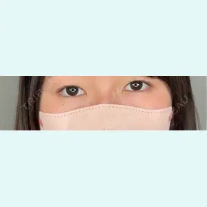 口コミ