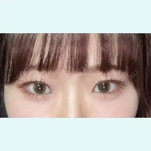 口コミ