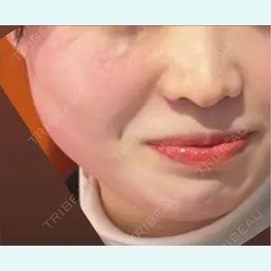 口コミ