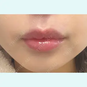 口コミ
