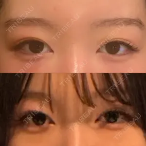 口コミ