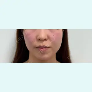 口コミ