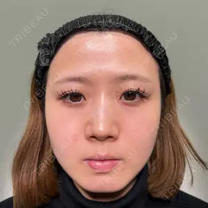 口コミ