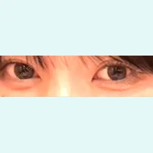 口コミ