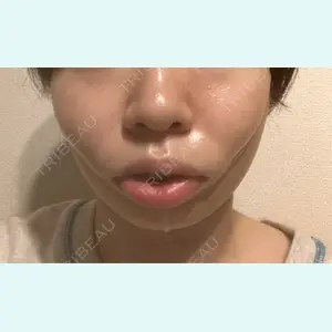 口コミ