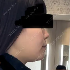 口コミ