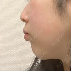 口コミ