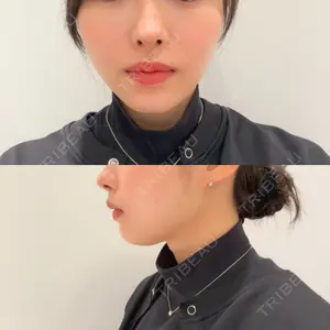 口コミ
