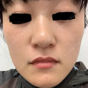口コミ