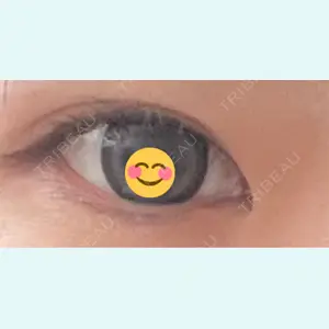口コミ