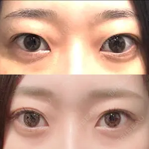 口コミ