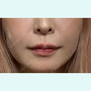 口コミ