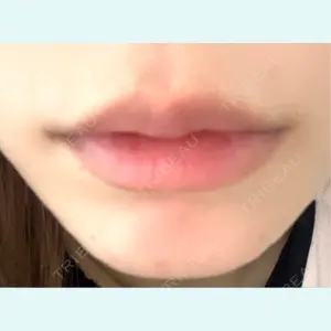 口コミ