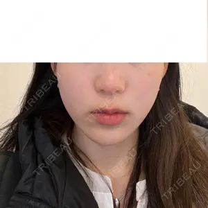 口コミ