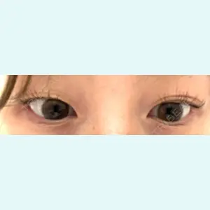 口コミ