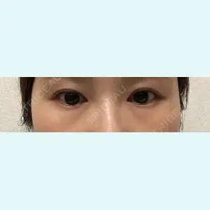 口コミ