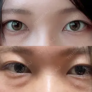 口コミ