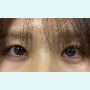 口コミ