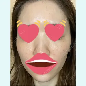 口コミ