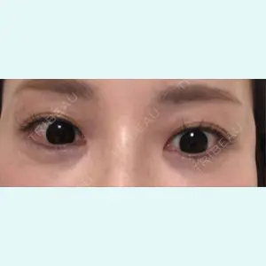 口コミ