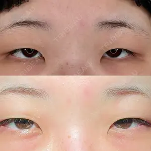 口コミ
