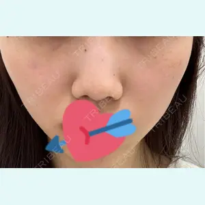 口コミ