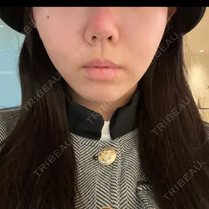 口コミ